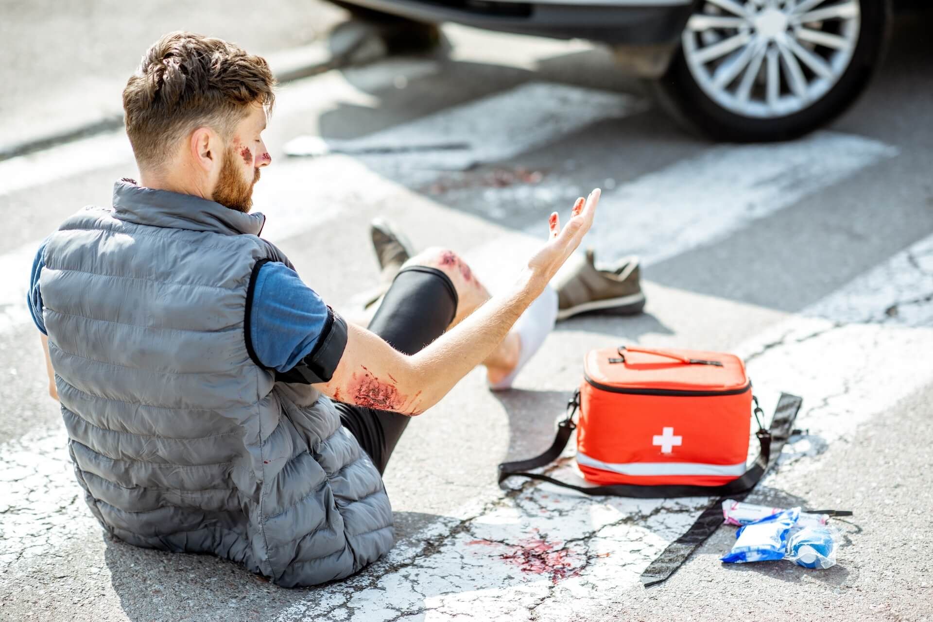 Injured man after the road accident.