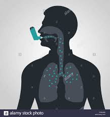 asthama
