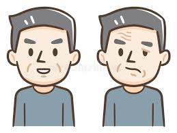 facial palsy