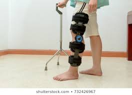 post surgery