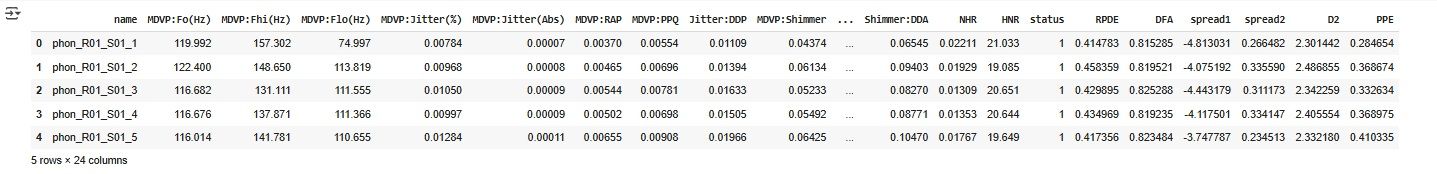 Verify the dataset-parkinson datset Verify the dataset-parkinson datset