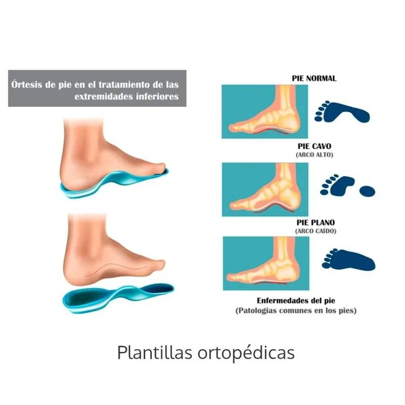 Plantillas Ortopédicas a Medida 4