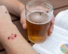 Why Mosquitoes Bite More After Beer: New Research Reveals Surprising Connection