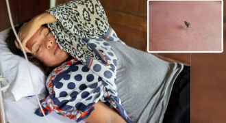 Dengue treatment