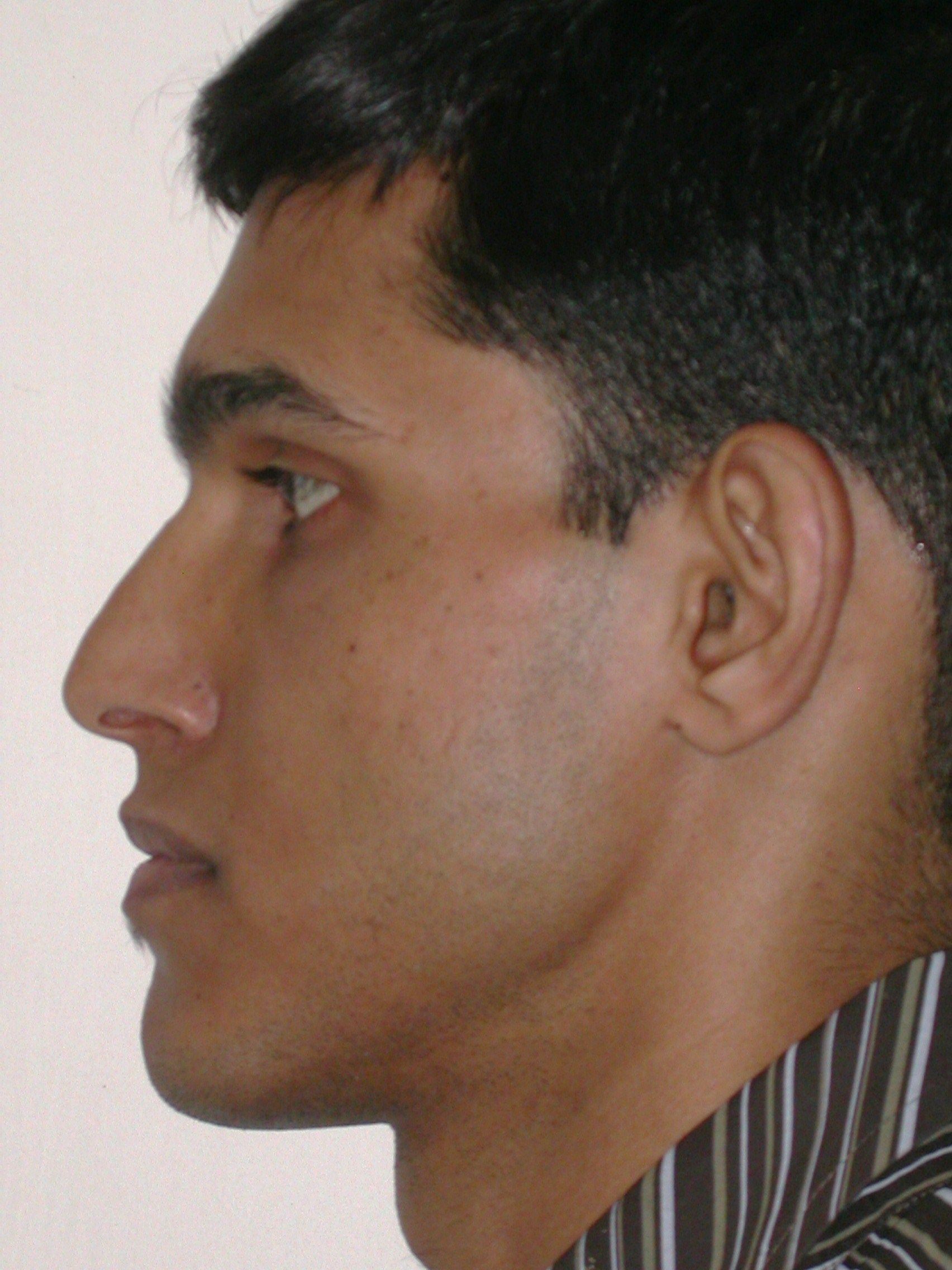 Cosmetic Procedures Available