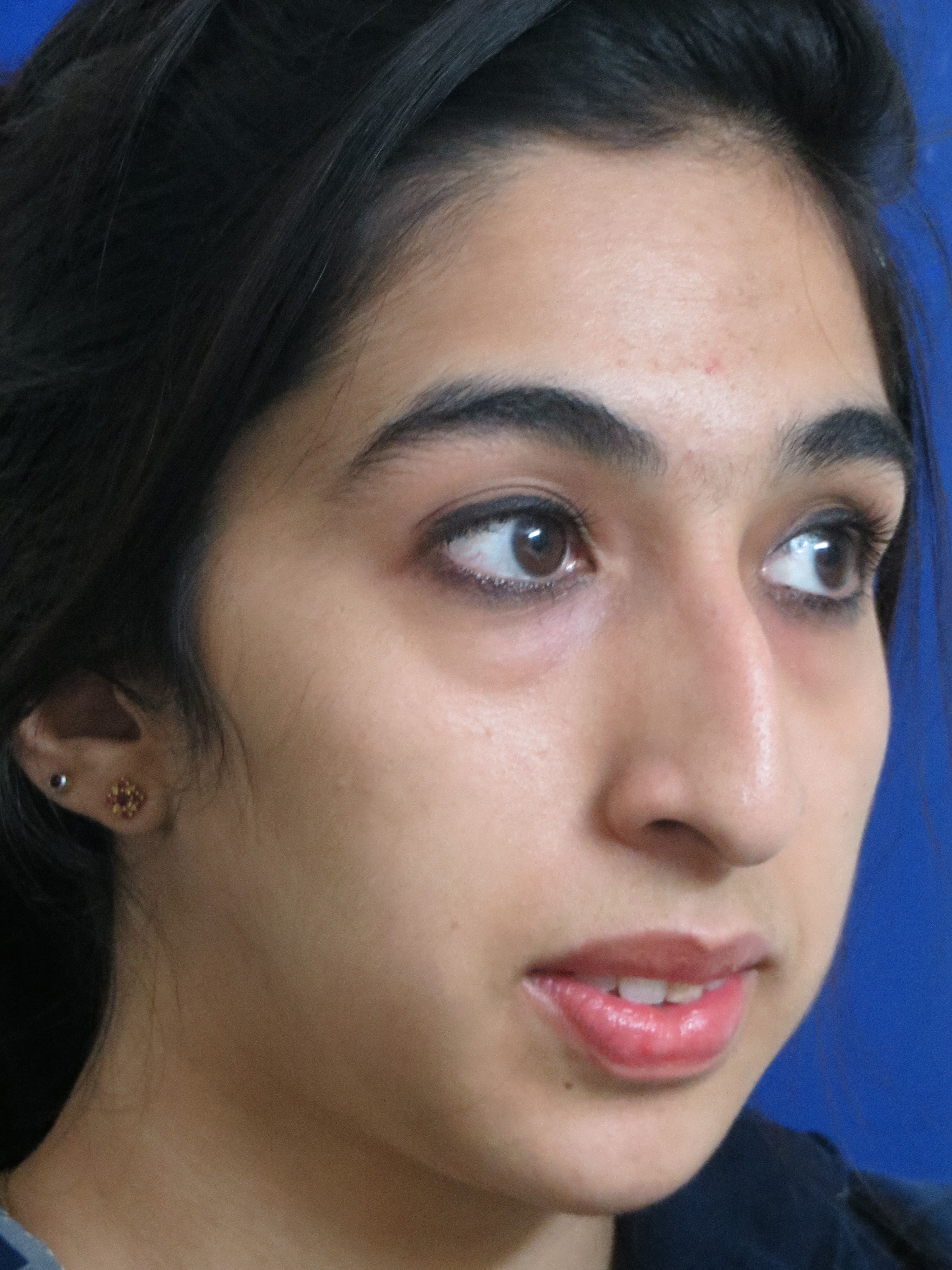 Cosmetic Procedures Available