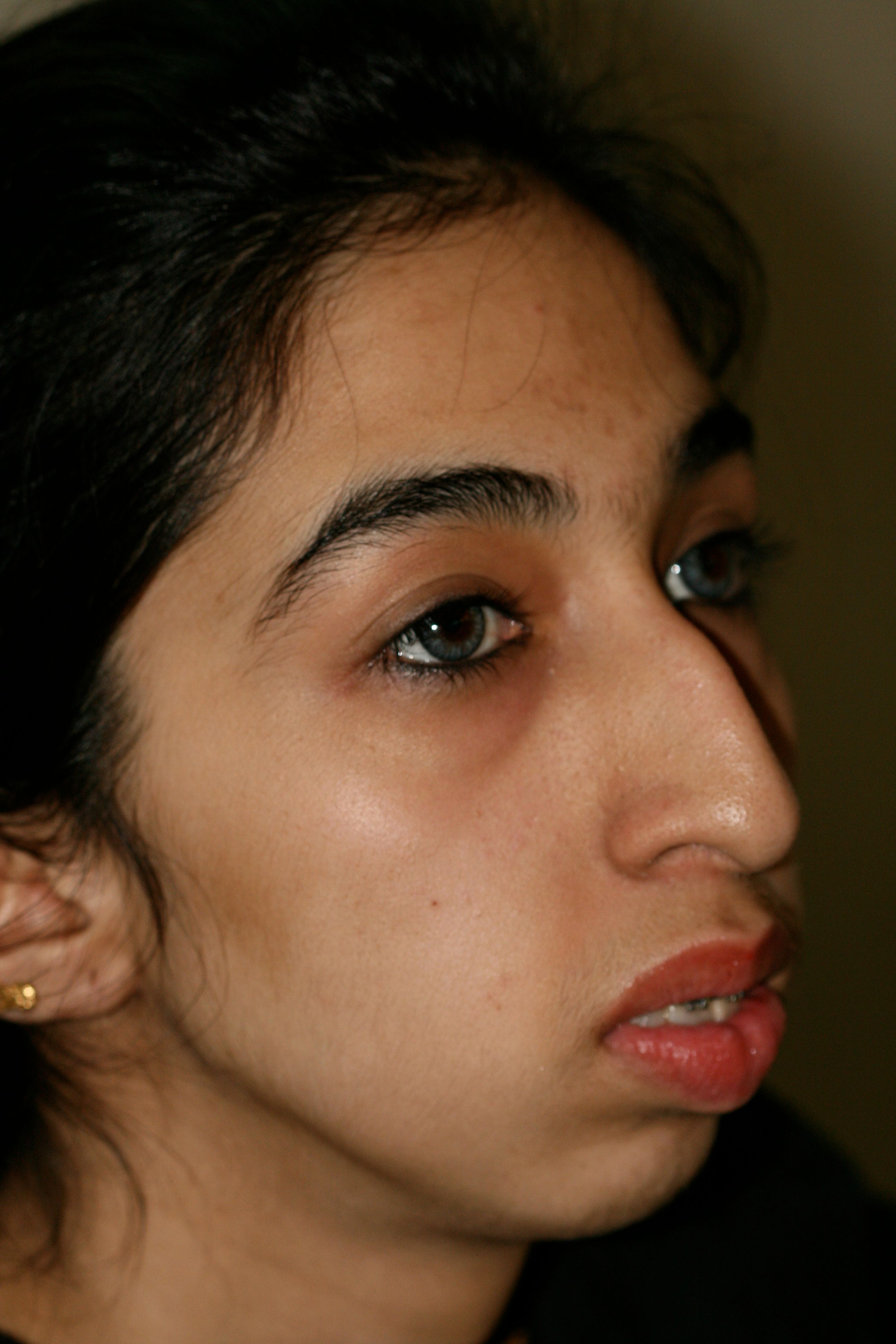 Cosmetic Procedures Available