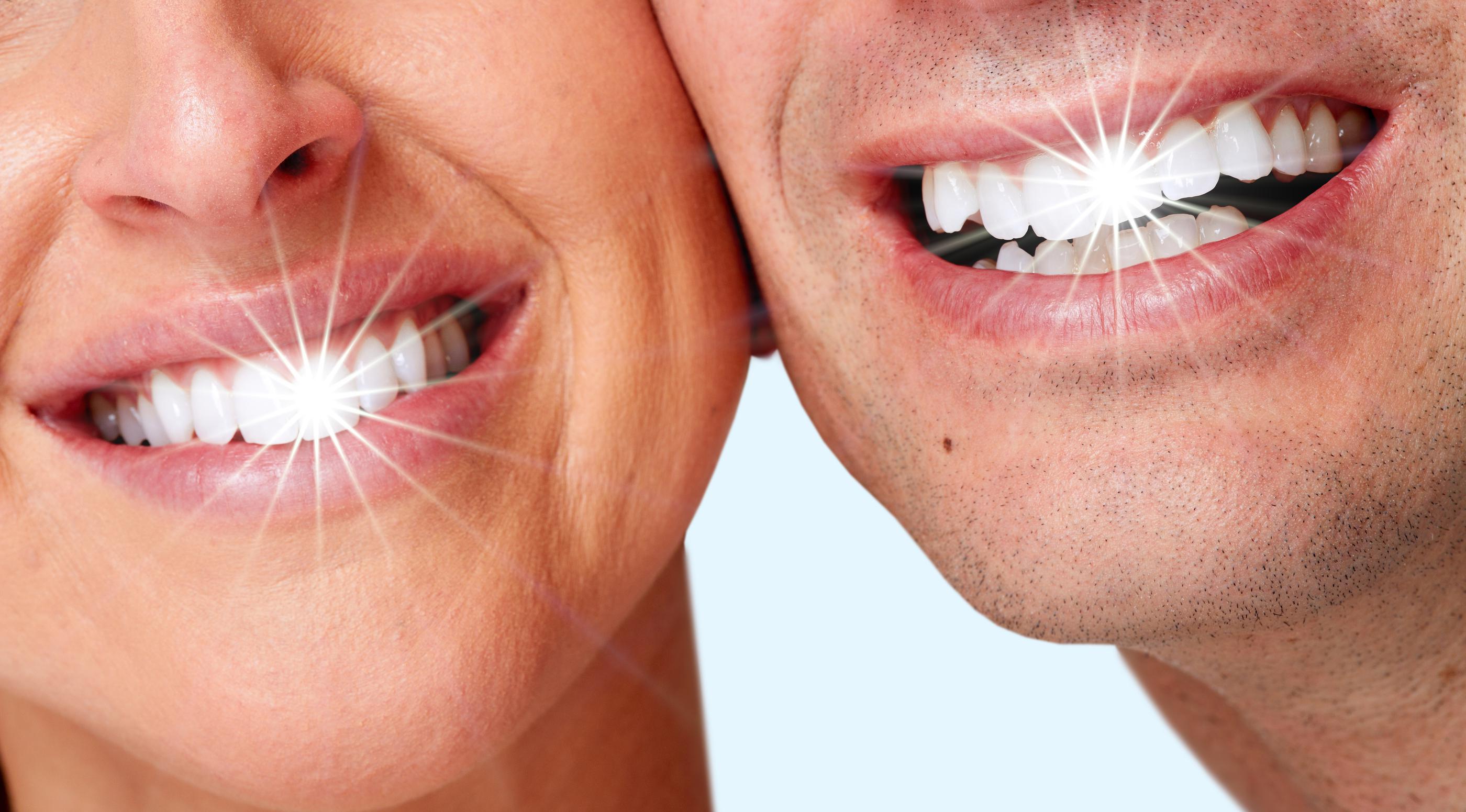 Professional teeth whitening treatment