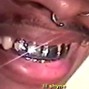 Soll - Plug