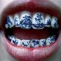 CELI-GANG - BNYX X YEAT TYPE BEAT - TEETH！