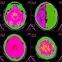 9ianni - mri - 148 - Cdor