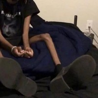 crohn