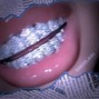 travindaniels5441 - permanent sleep 