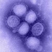 H1N1