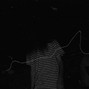 CRCL - nerves