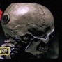 CRCL - CADAVER
