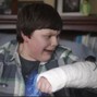 nezu - arm cast