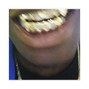 NEL - Bottom grillz