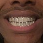 OVNI BEATS - SOLUTION - STEVE LACY