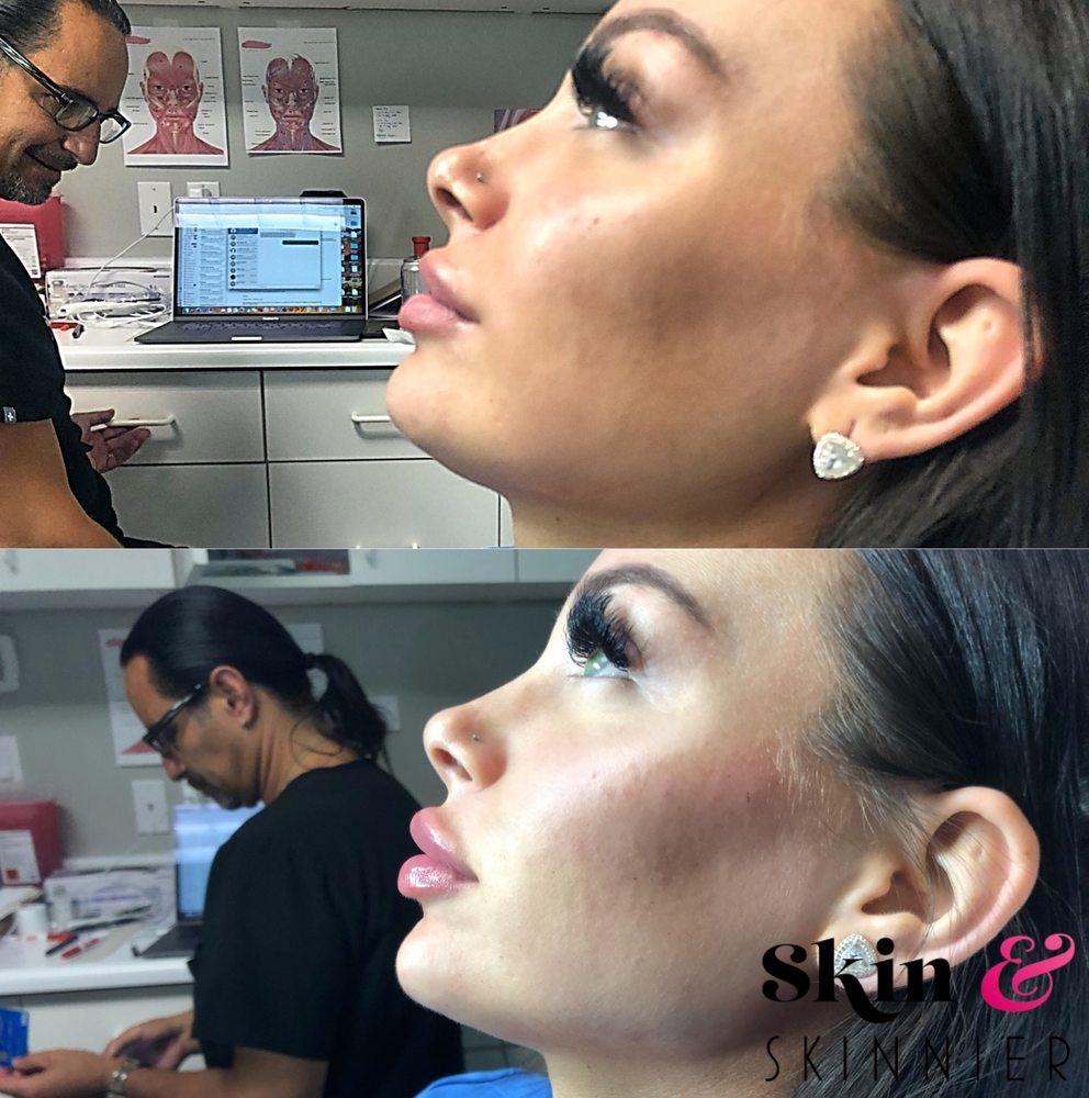 Skin & Skinnier Medical Spa