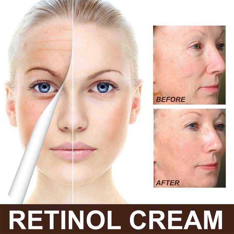 Retinol Wrinkle Remover Face Cream Anti-Aging Firming Lifting korean skin care products Fade Fine Lines Moisturizing Cosmetics