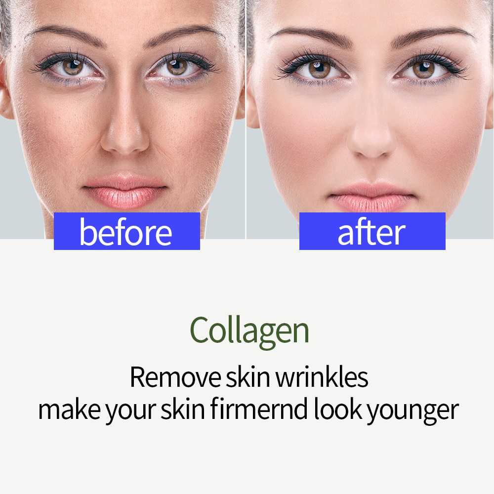 ENVISHA Face Skin Care Collagen Hyaluronic Acid Serum Retinol Vitamin Anti-Aging Wrinkle Moisturizing Whitening Shrink Pores