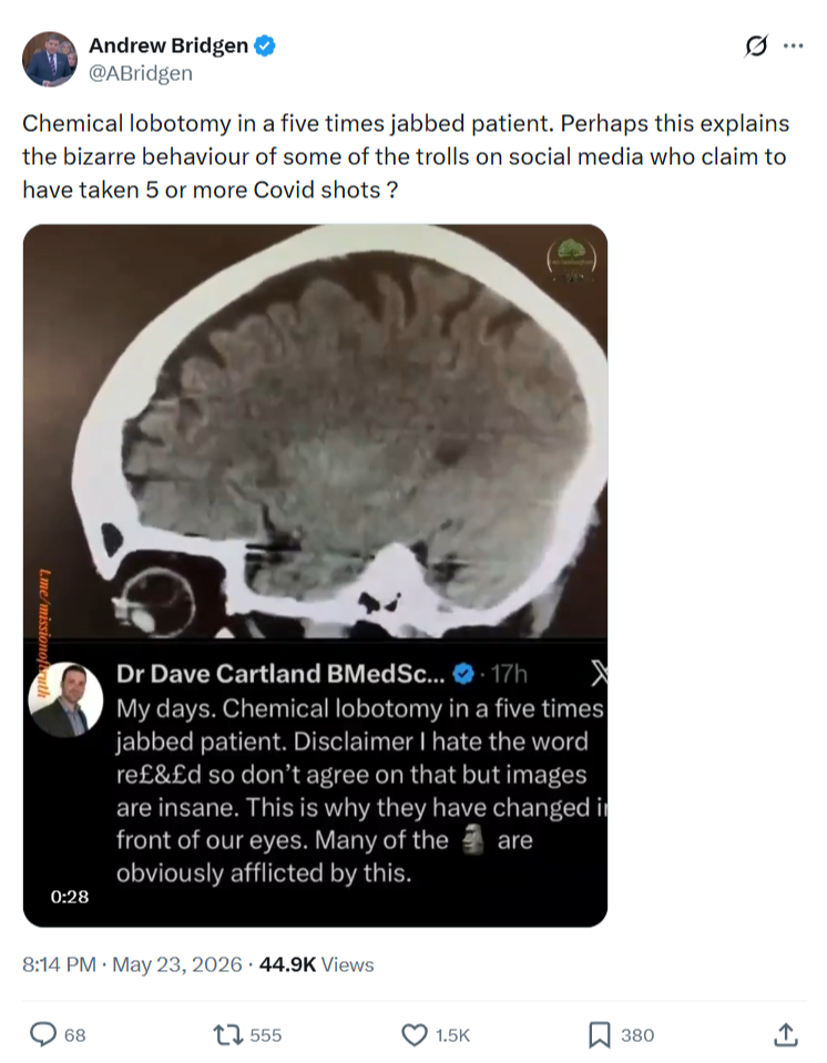Andrew Bridgen: Chemical lobotomy in a five times…