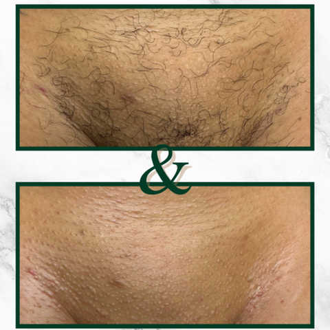 gallery image in our gallery