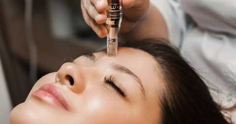 Nanoneedling Facial