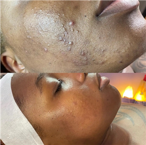 gallery image in our gallery