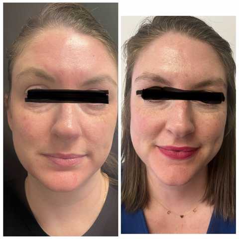 gallery image in our gallery