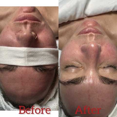 gallery image in our gallery