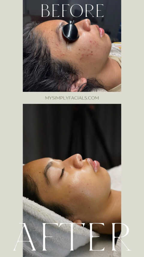 gallery image in our gallery