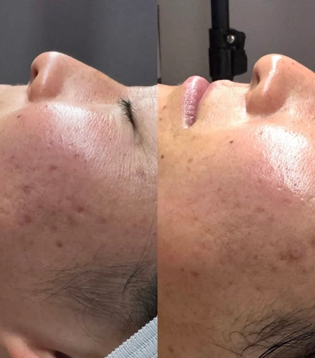 Anti-Aging, Lines & Firmness