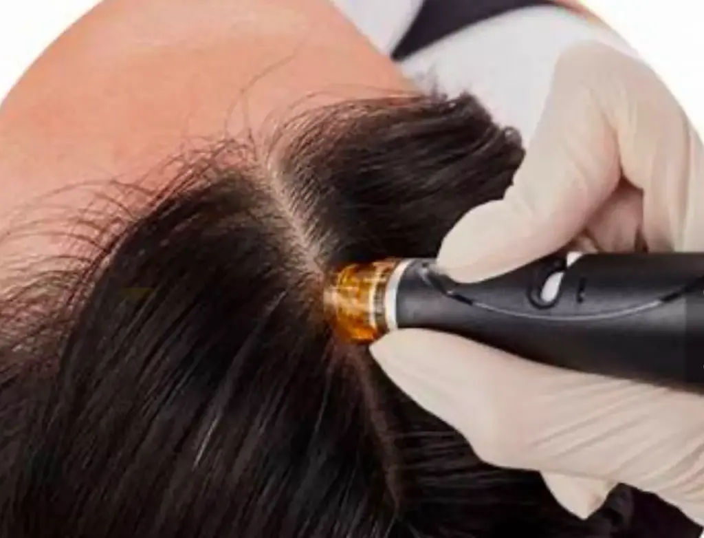 Scalp Treatment