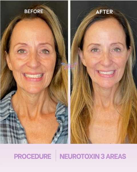 gallery image in our gallery