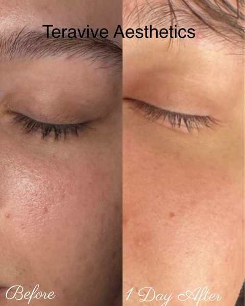 gallery image in our gallery