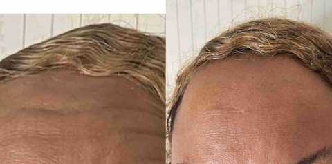 gallery image in our gallery