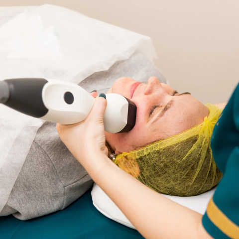 Micro needling