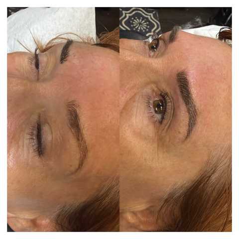 Eyebrow: Microblading