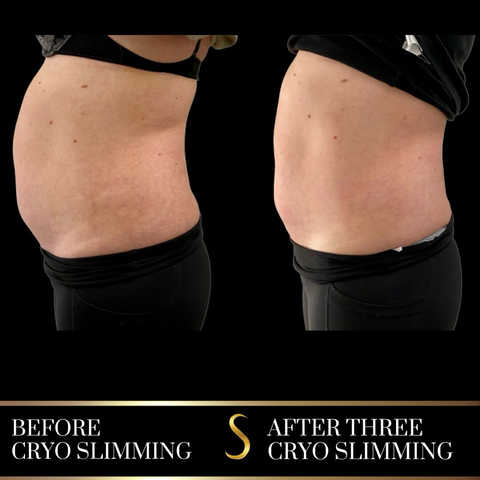 gallery image in our gallery