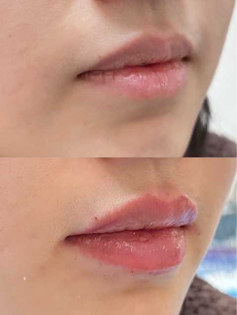 gallery image in our gallery