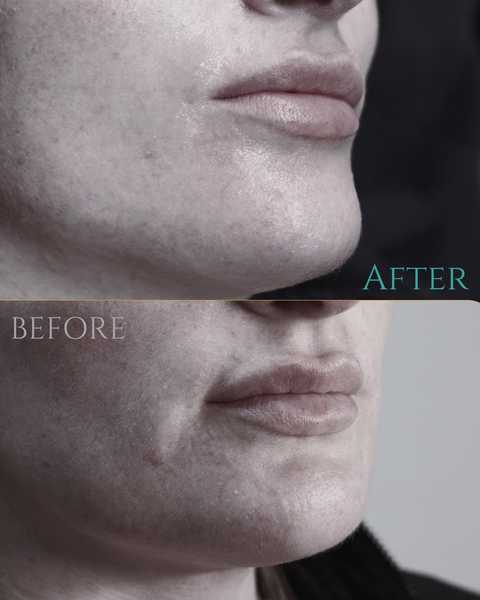 gallery image in our gallery