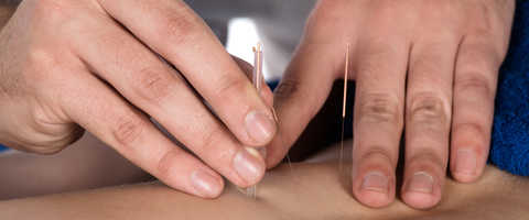 About Center Acupuncture