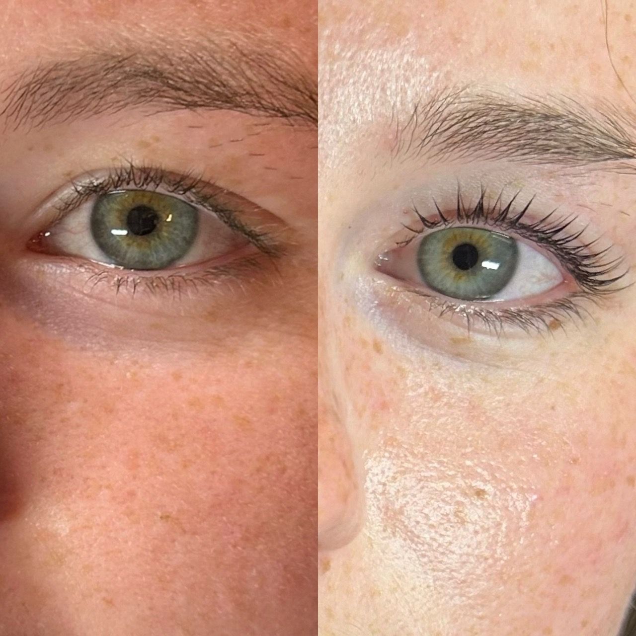  eyes,comparison,skincare,beauty,results  