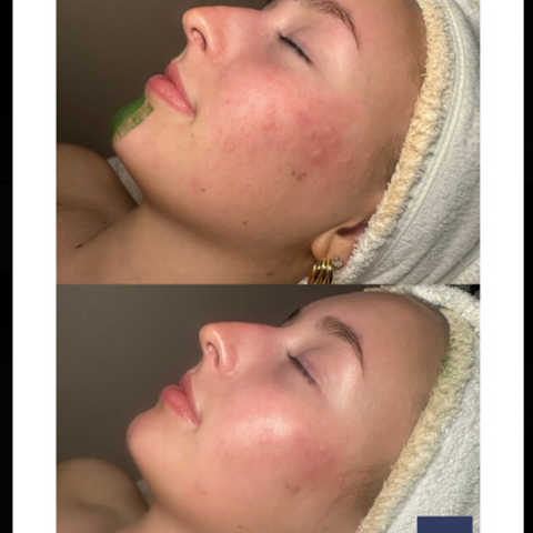 gallery image in our gallery