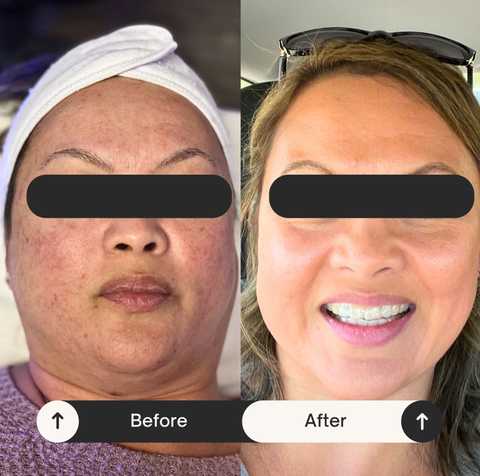 gallery image in our gallery