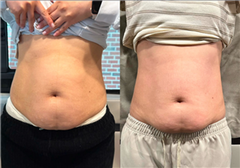 gallery image in our gallery