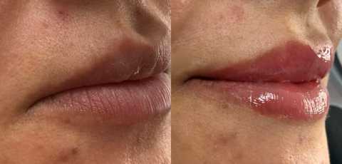 gallery image in our gallery