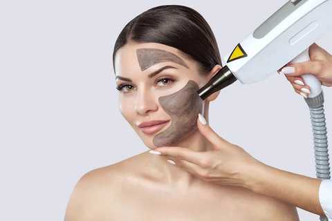 Carbon laser facials
